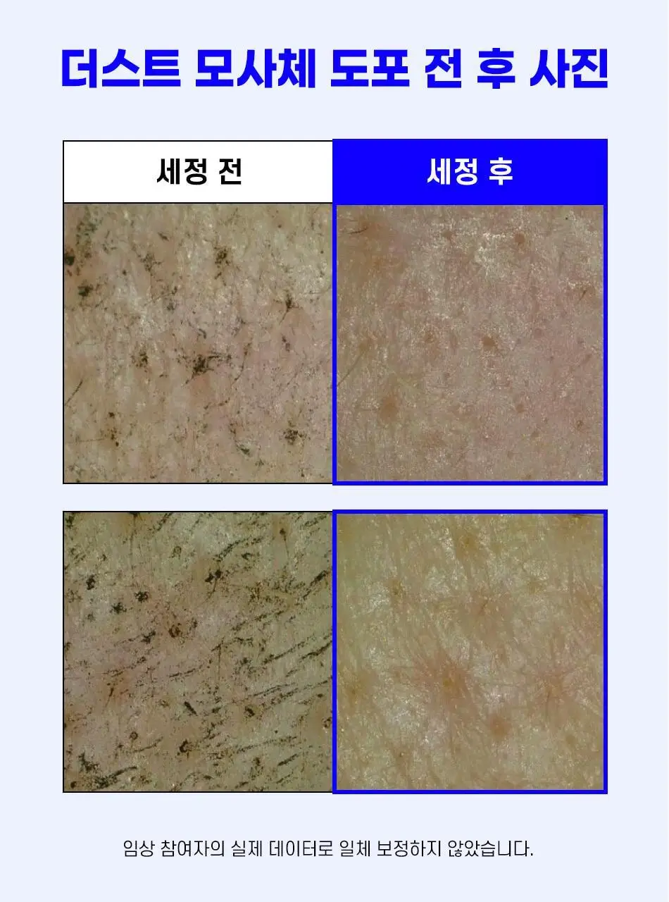 [모공청소팩] 안티톡스 스파클린 마스크 포어필 1매 상세페이지 17